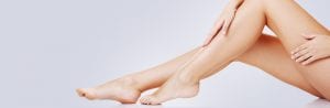 Woman's legs after vein therapy