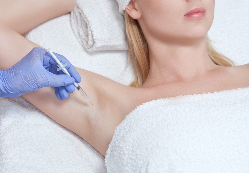 woman getting botox in her underarms