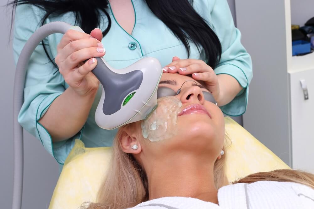 woman getting ipl photofacial after sun damage