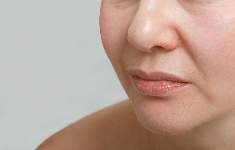 Nasolabial Folds close up on woman's face.