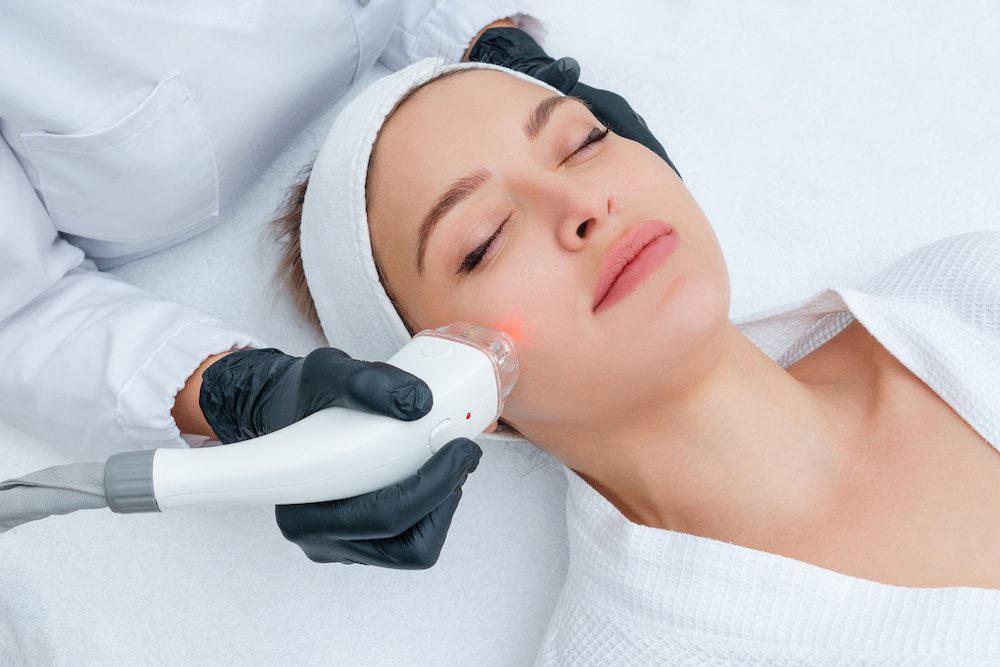 Laser Facial Hair Removal: Can You Use Laser Hair Removal On Your